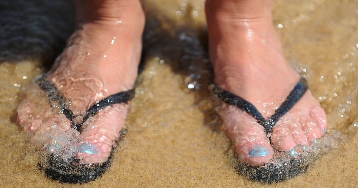 People urged to seek medical help if heatwave swollen ankles do one thing