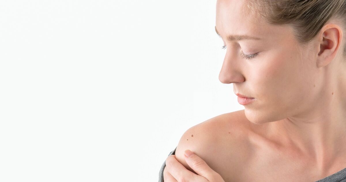 Skin spot 'rule' dermatologist says indicates time to see doctor