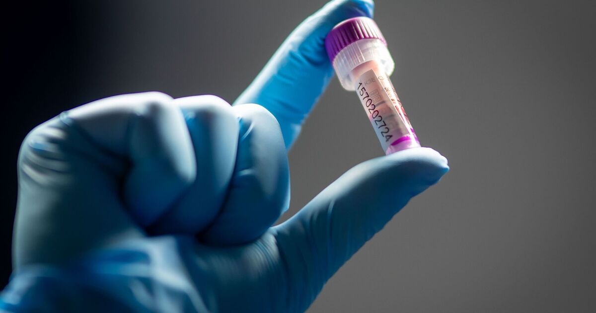NHS bombshell as hospital becomes first in England to offer women cancer test