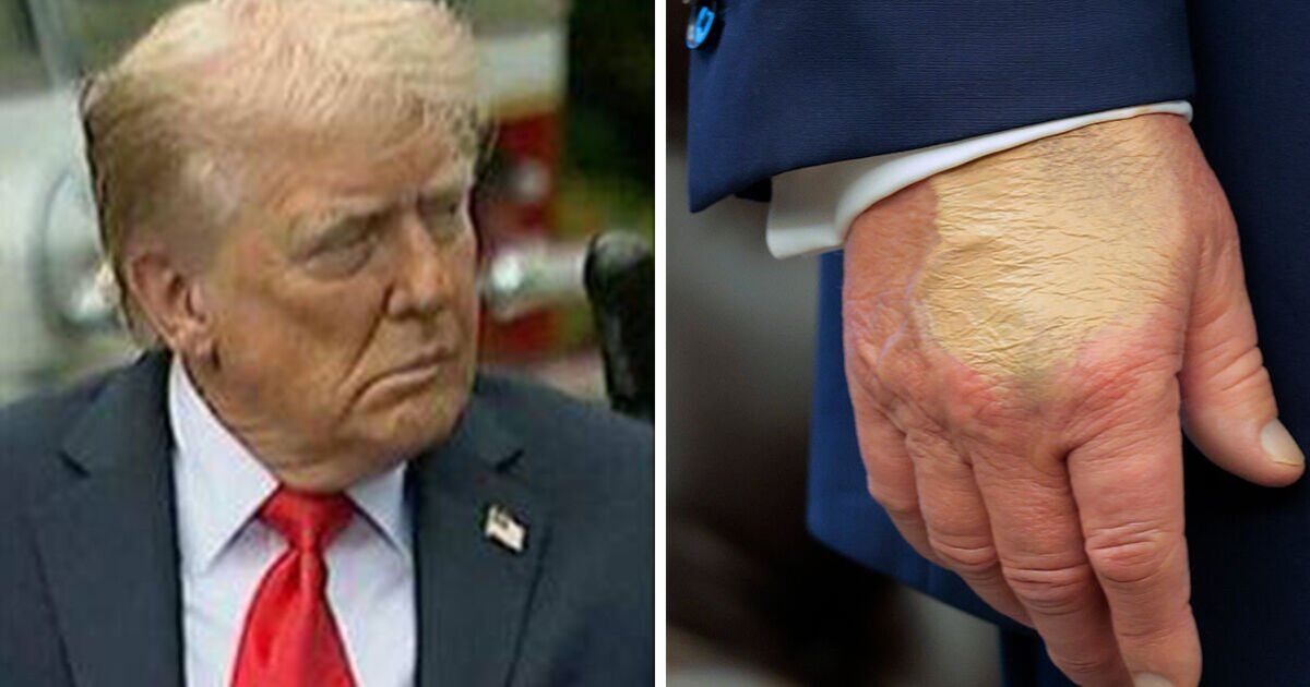 Trump health fears prove every ageing world leader must take this 1 test, expert says