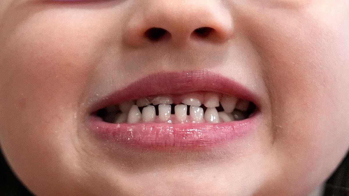 FDA, BEYİN HASARINA neden oldukları endişesiyle popüler takviyeleri yasaklamaya hazırlanıyor