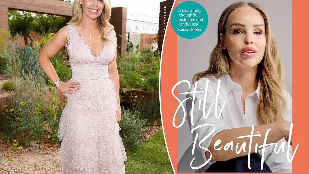 Still Beautiful von Katie Piper: Begründen Sie Ihren Wert nicht mit Ihrem Aussehen