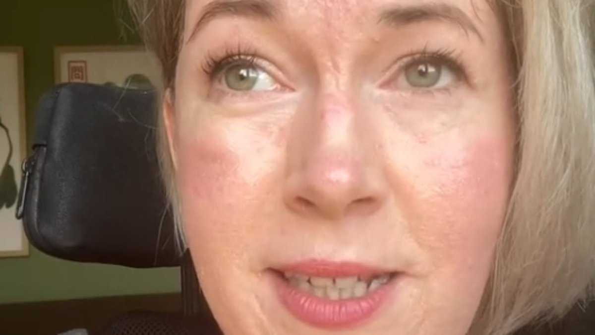 Menschen sind entsetzt, nachdem behinderte Frau behauptet, der NHS habe sie zum Wiegen in eine Tierhandlung geschickt