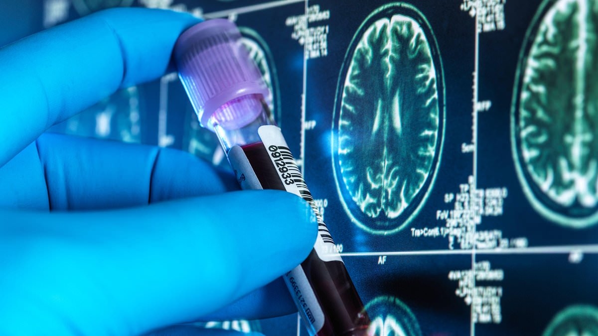 Thousands of Britons to receive cheap blood tests for Alzheimer's in landmark trial