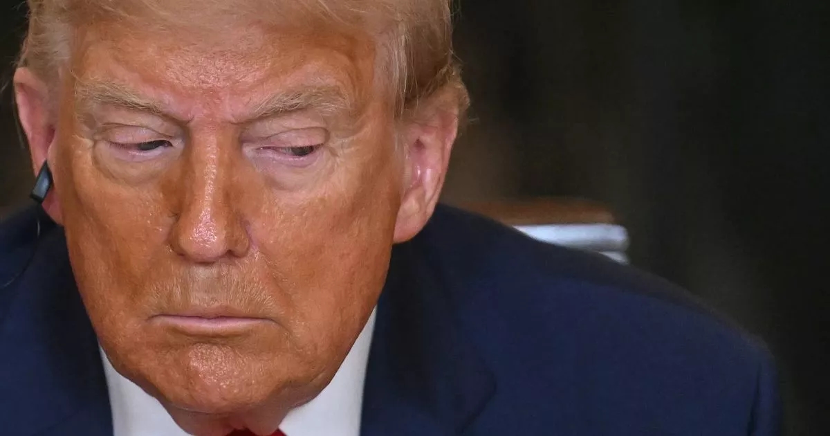 Chronische veneuze insufficiëntie: symptomen en behandeling van de aandoening die Donald Trump treft