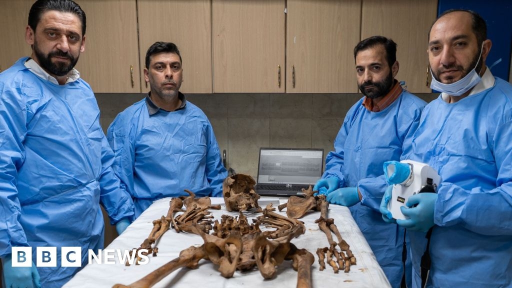 “Este será un trabajo de años”: Los médicos identifican restos de las fosas comunes de Siria