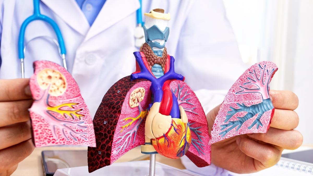 111 cas de tuberculose signalés dans la prison Modelo de Bucaramanga : comment est-elle contrôlée ?