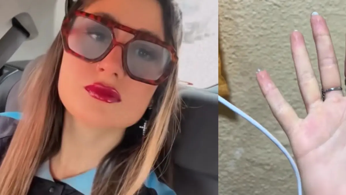 Brandweerlieden hebben de vinger van een vrouw gered die vastzat in een ring.