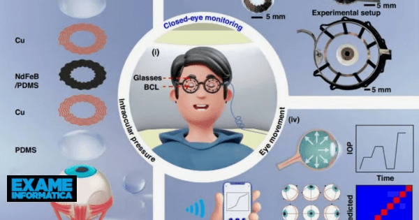 Le lenti a contatto monitorano i segni del glaucoma, anche mentre chi le indossa dorme
