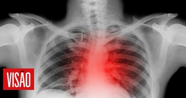 The democratization of life-saving cardiac exams