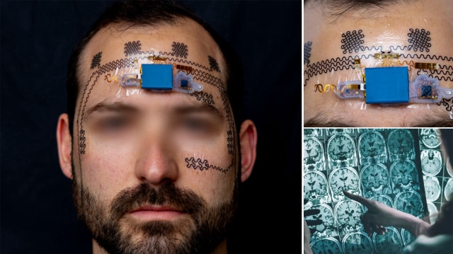 Tatouage électronique contre le stress au travail : il déclenche une alarme lorsque vous travaillez trop
