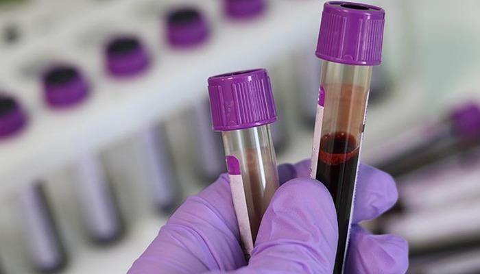 Genetisch gevaar... Testen is een must voor het huwelijk: Thalassemie verspreidt zich in stilte! Deskundigen waarschuwen: "Het dragerschap van thalassemie bedraagt ​​2,1 procent"