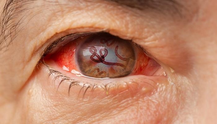 Doença horrível: literalmente apodrecendo por dentro! Vírus semelhante ao ebola mata 8 pessoas