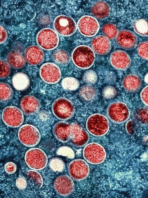 Mpox is mainly transmitted through sex between men.