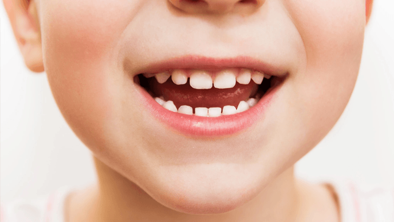 Mondverzorgingstips voor kinderen in de zomer van een expert