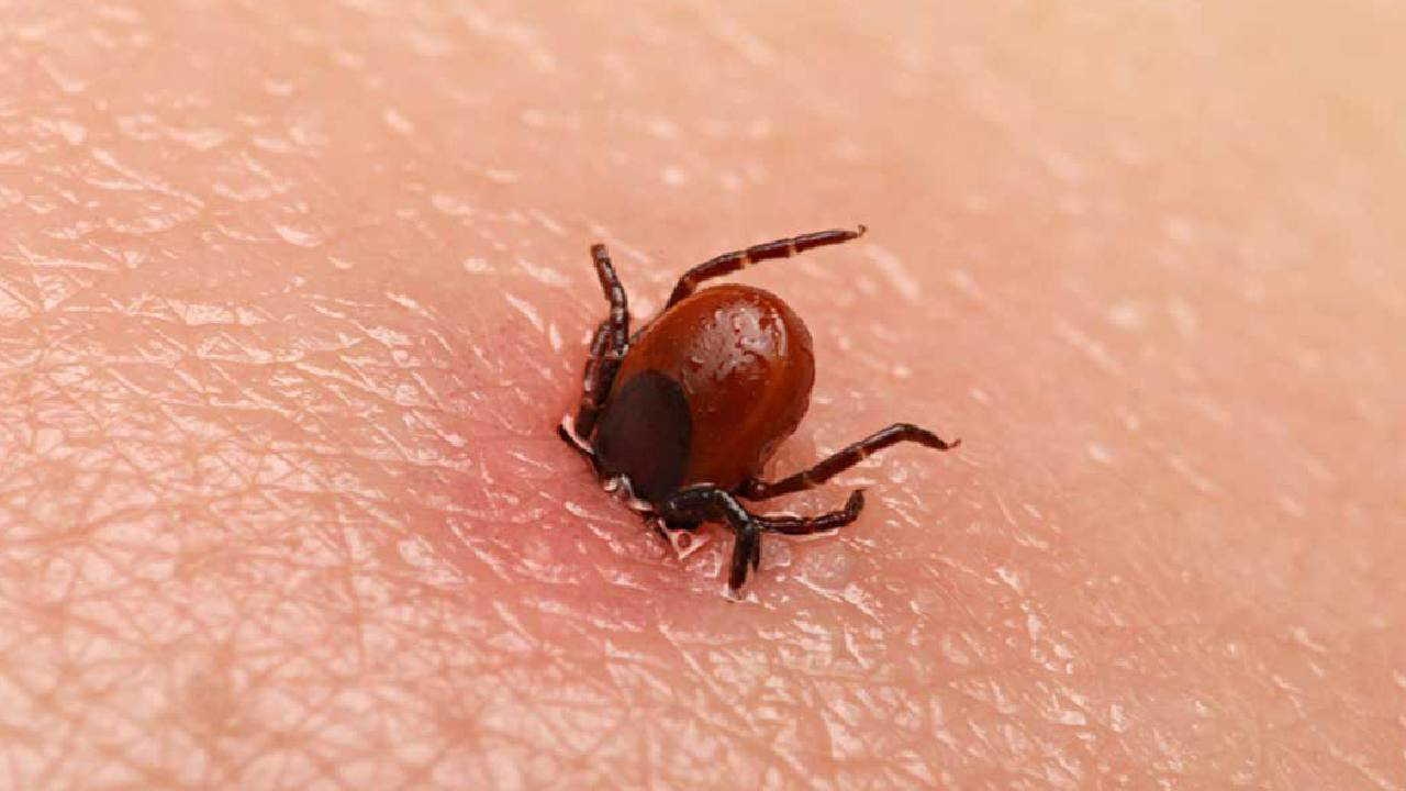 Attention aux tiques ! Que faire face à la hausse des cas de FHCC en été ?