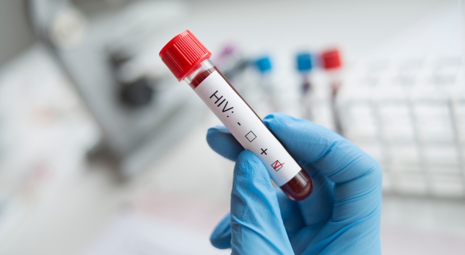 E quanto ao tratamento do HIV para quem não tem plano de saúde? Fundo Nacional de Saúde (NFZ): Sem uma fonte de financiamento clara, essa é uma tarefa impossível.