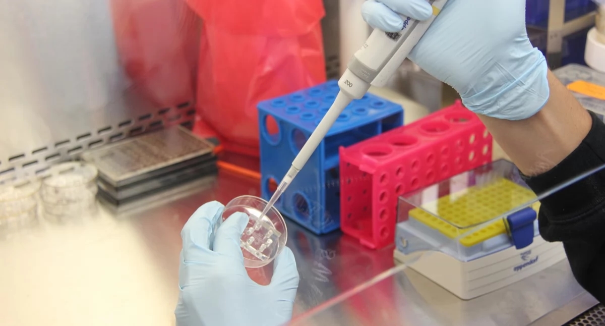 Genetica van medicijnresistente epilepsie: nieuwe bevindingen kunnen de behandeling van de ziekte veranderen