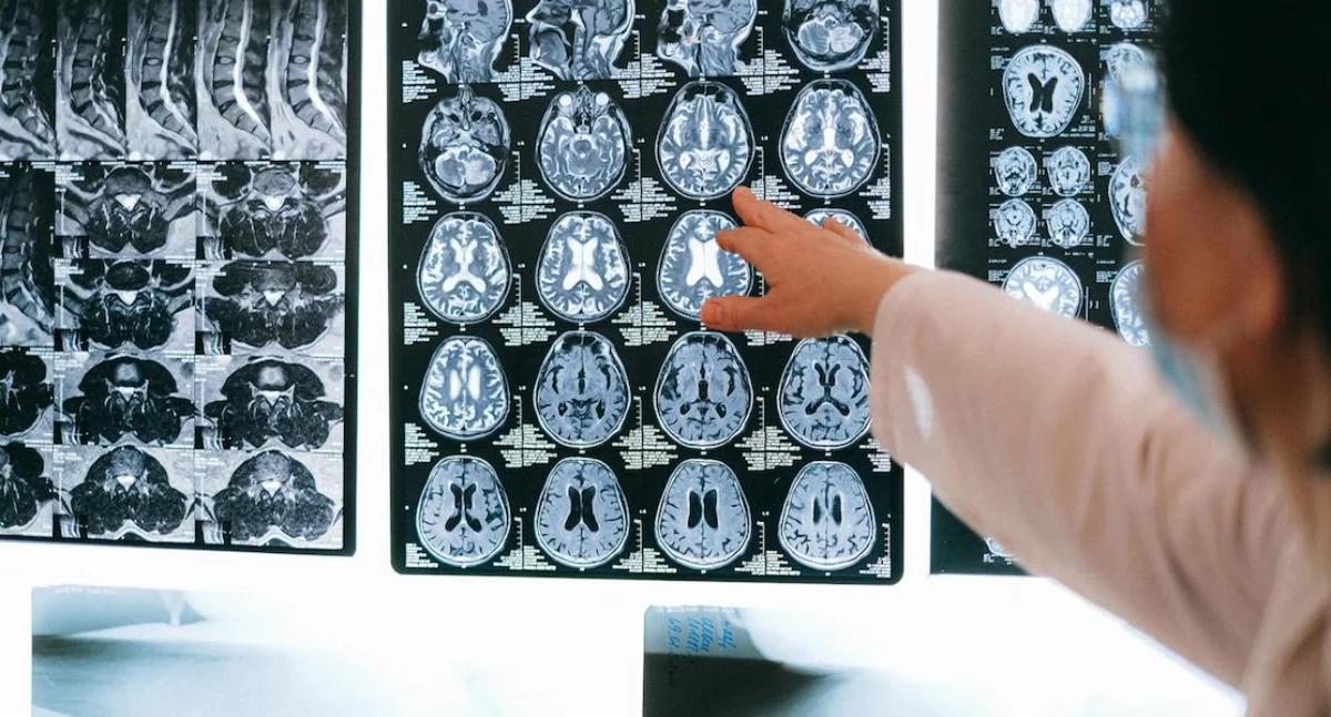 Armoede, stress, geweld. Nieuw onderzoek toont aan hoe de kindertijd de hersenen voor de komende jaren littekens achterlaat