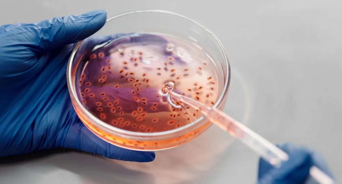 New weapon against ovarian cancer: radioimmunotherapy eliminates cancer stem cells