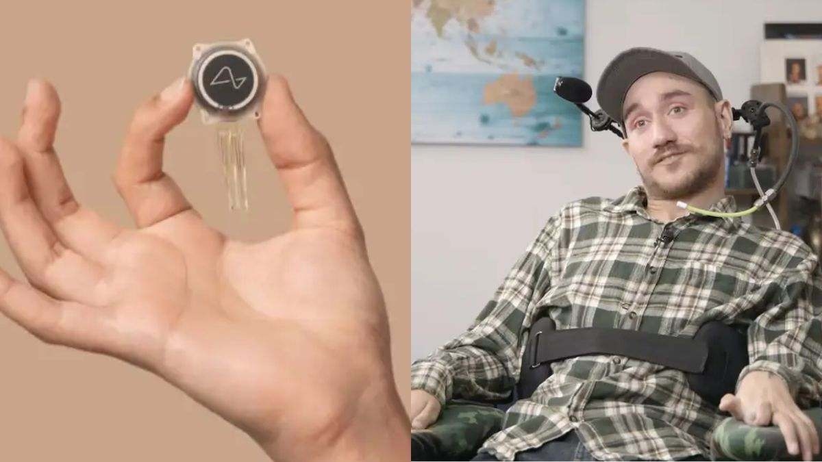 The man whose brain chip was implanted by Musk shows how he is doing 18 months later: "It shouldn't be possible..."