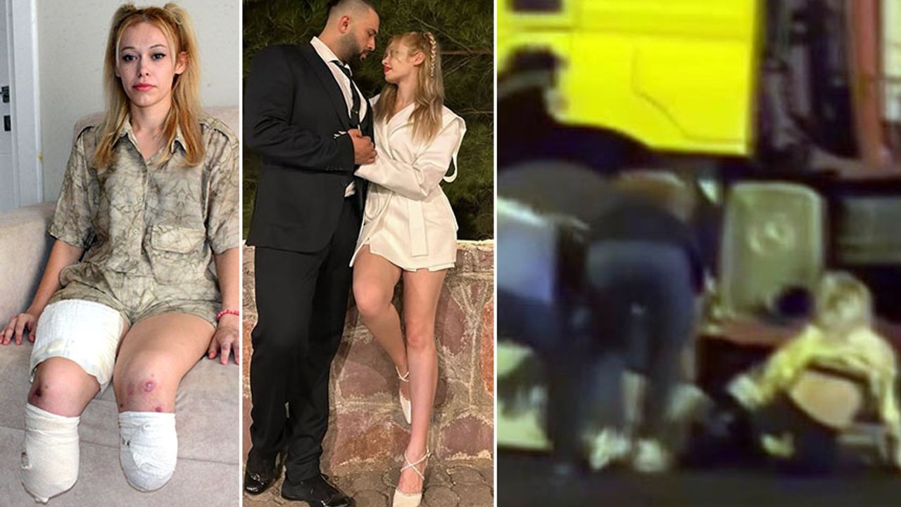 He lost his legs while going to celebrate his wedding anniversary.