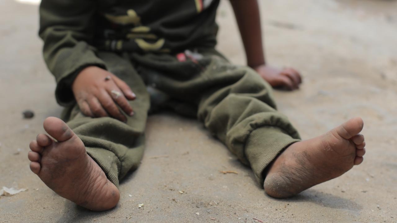 Demanda contra el Reino Unido por negar tratamiento y evacuación a niños de Gaza