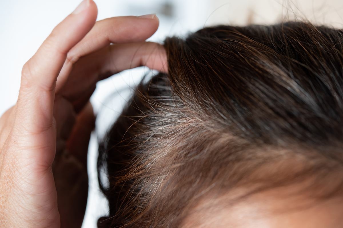 Keine grauen Haare mehr: Natürliche Rezeptur deckt das Haar in Minuten ab