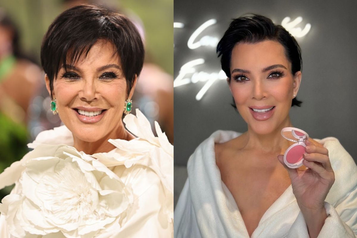 Kris Jenner: il medico svela i trucchi che l'hanno resa "20 anni più giovane"