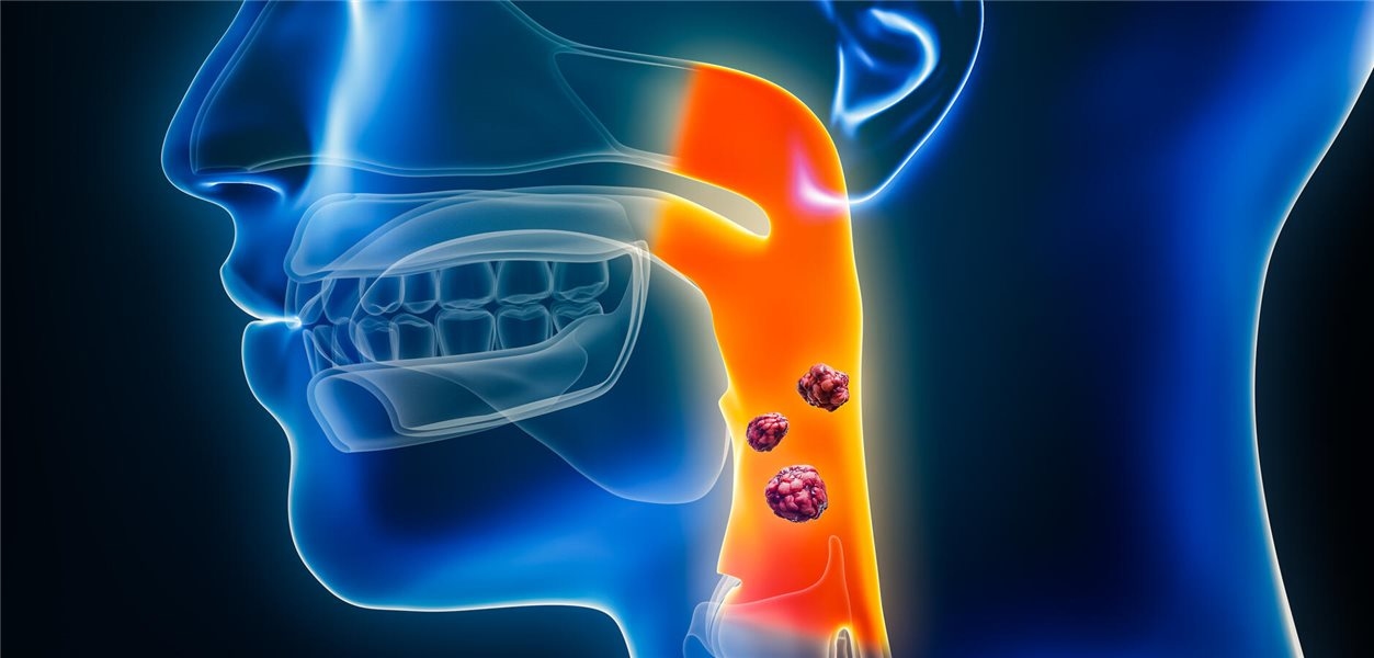 Tumores metastáticos de cabeça e pescoço: imunoterapia com benefício de sobrevida limitado