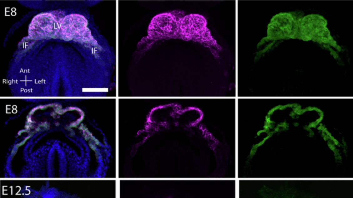 Naissance cardiaque filmée en 3D dans un embryon de souris