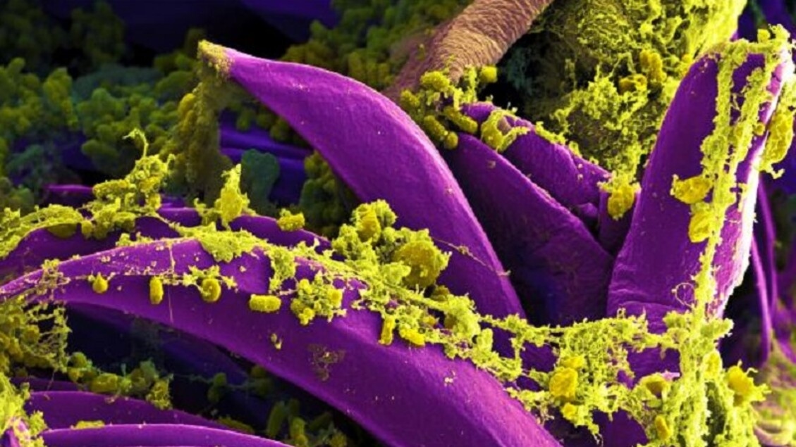 Die Pest dauerte Jahrhunderte wegen eines Gens