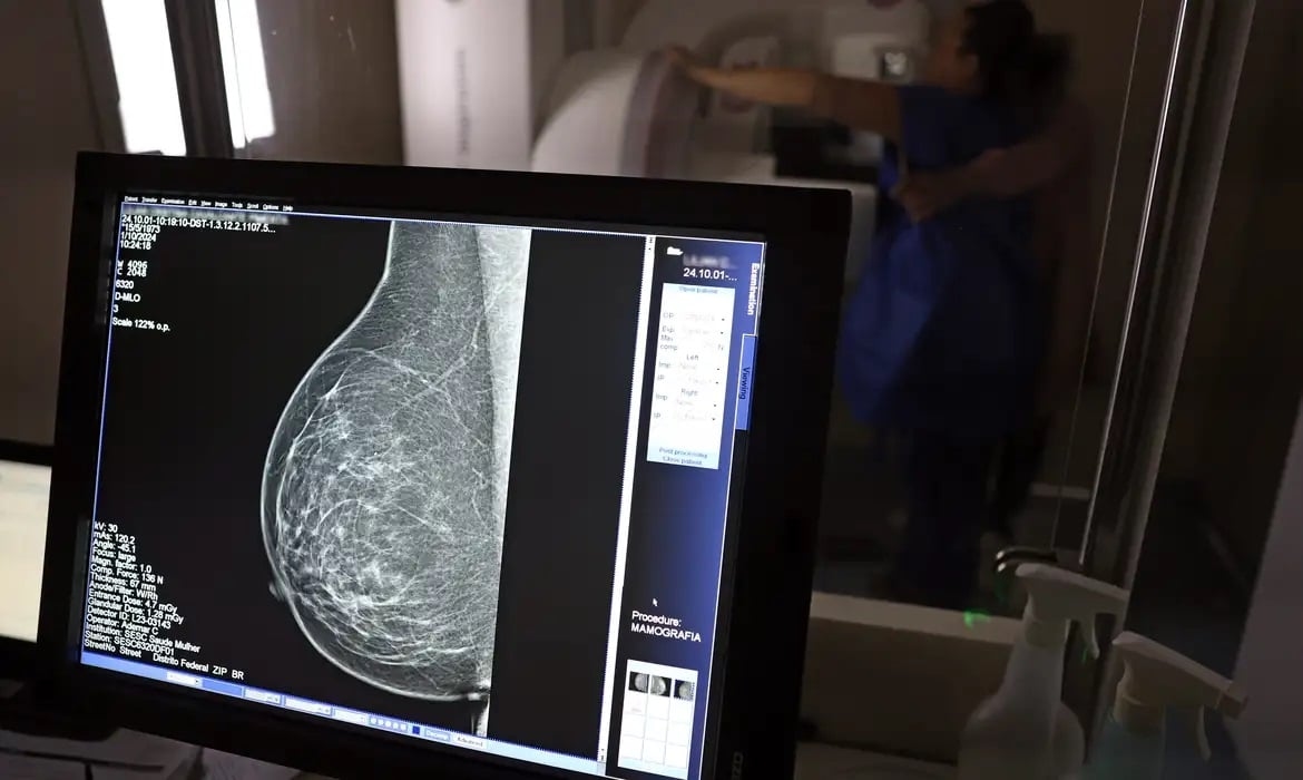 Ministry of Health now recommends mammograms for people aged 40 and over