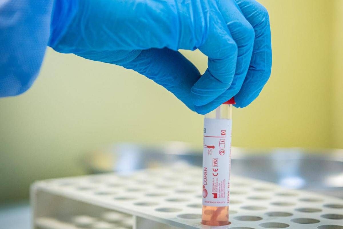 Исследование Long Covid genetics показало: вариант увеличивает риск на 60%