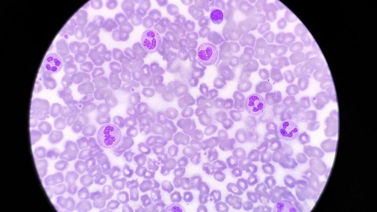 Tageslicht kann die Fähigkeit des Immunsystems zur Bekämpfung von Infektionen stärken