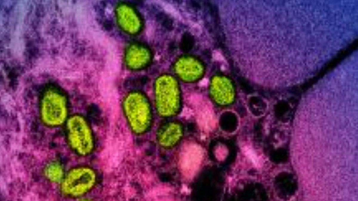 La Spagna segnala il primo decesso per MPOX, o vaiolo delle scimmie, dal 2022.
