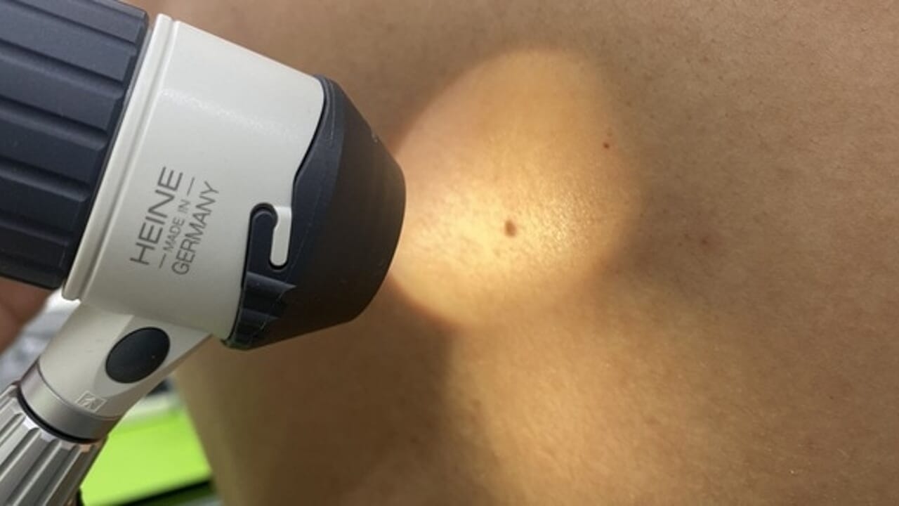 Consultas dermatológicas gratuitas para seus funcionários: iniciativa da empresa Alta