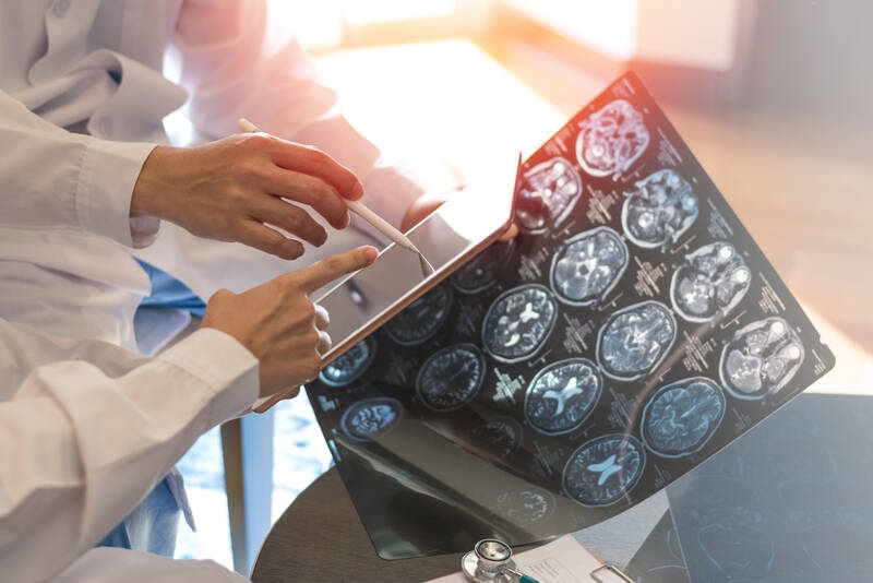 Avanços no diagnóstico: a esclerose múltipla agora é diagnosticada mais rapidamente
