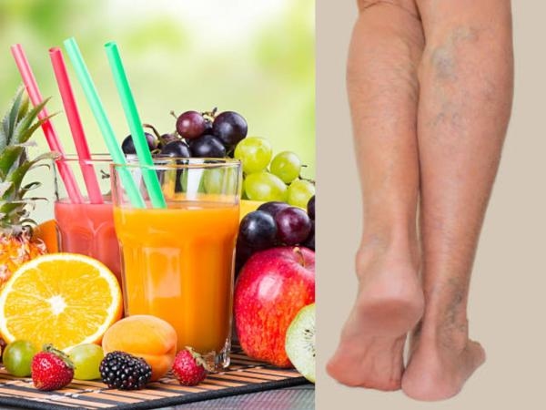 Los tres jugos que lo salvarán de las varices: son ricos y refrescantes