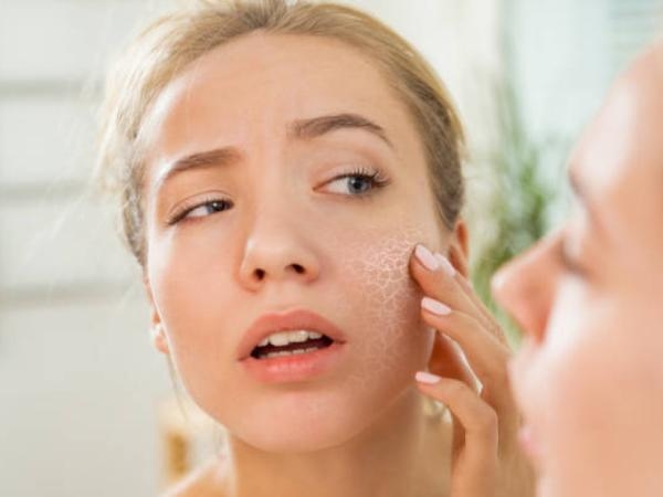 Pul pul dökülen cilt ve kuru gözler: Bu vitaminin eksikliği vücudunuzu mahvedebilir