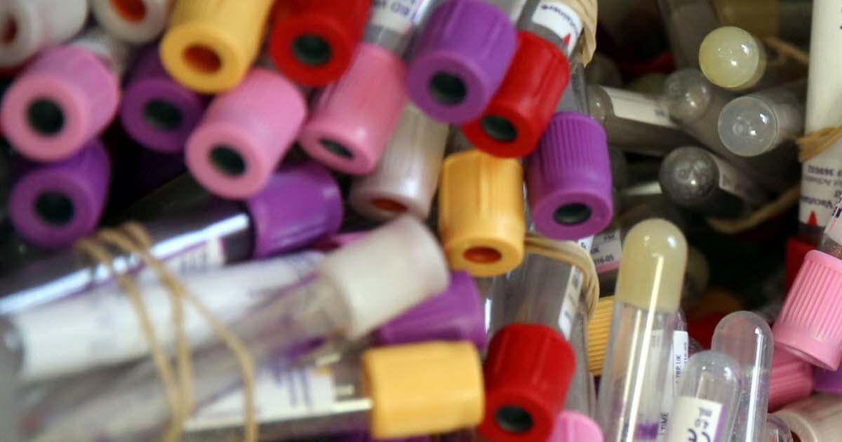 Trieux. Collecte de sang vendredi 5 décembre