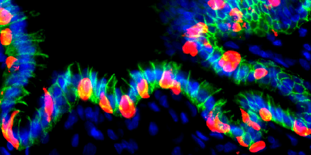 Le cellule dello stomaco riprogrammate producono insulina per curare il diabete