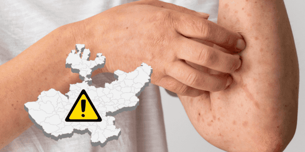 O Departamento de Saúde de Jalisco confirma novo caso de sarampo em escola particular de ensino médio em Zapopan.